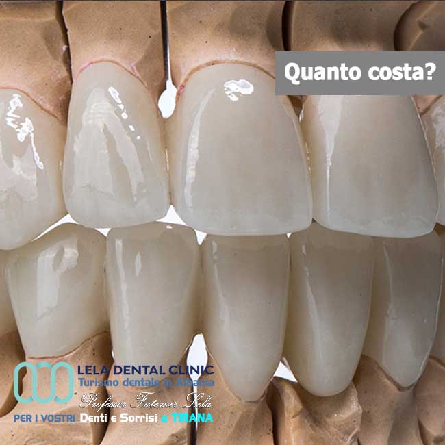 denti-corone-in-zirconio-per-estetica-dentale-in-albania-a-tirana