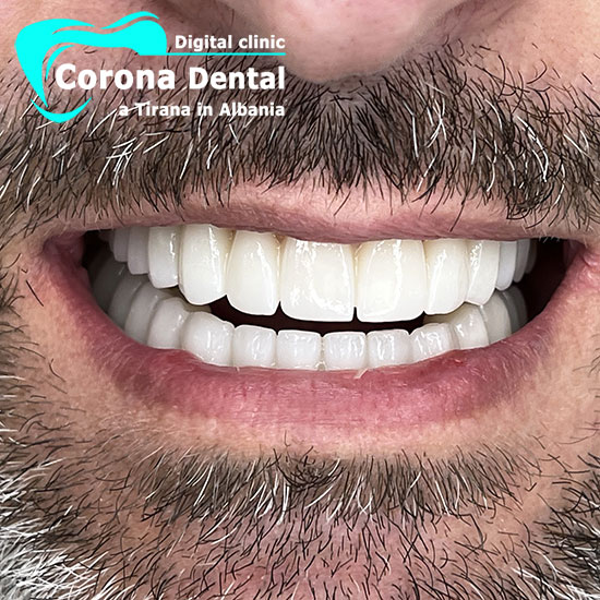 quarto-dentista-corona-dental