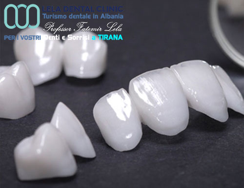 prezzo-denti-corone-in-zirconio-ceramica-in-albania-a-tirana