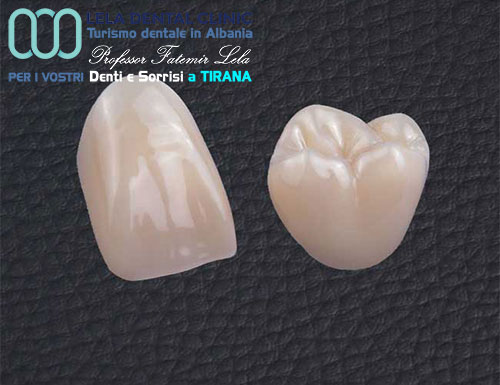 prezzo-denti-corone-in-zirconio-in-albania-a-tirana