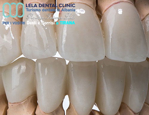 prezzo-estetica-dentale-con-denti-corone-in-zirconio-in-albania-a-tirana