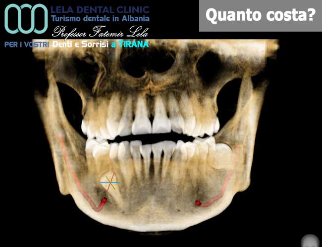 TAC-3D-fondamentale-per-ogni-intervento-di-chirurgia