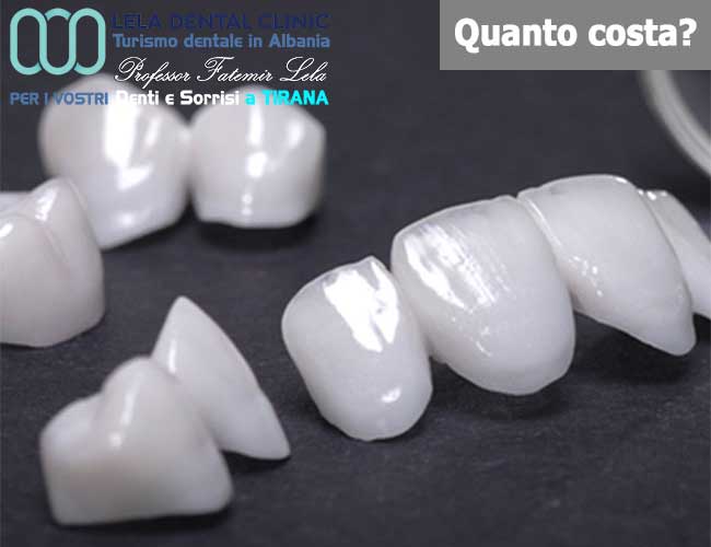 denti-corone-o-capsule-singole-e-ponti-in-zirconio-in-Albania-a-Tirana