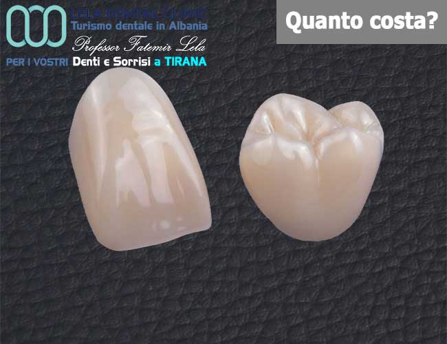 denti-corone-o-capsule-singole-in-zirconio-in-Albania-a-Tirana