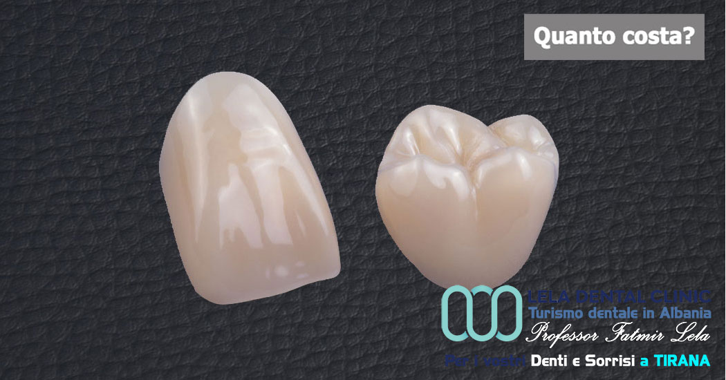 denti-corone-in-zirconio-singole-albania-tirana