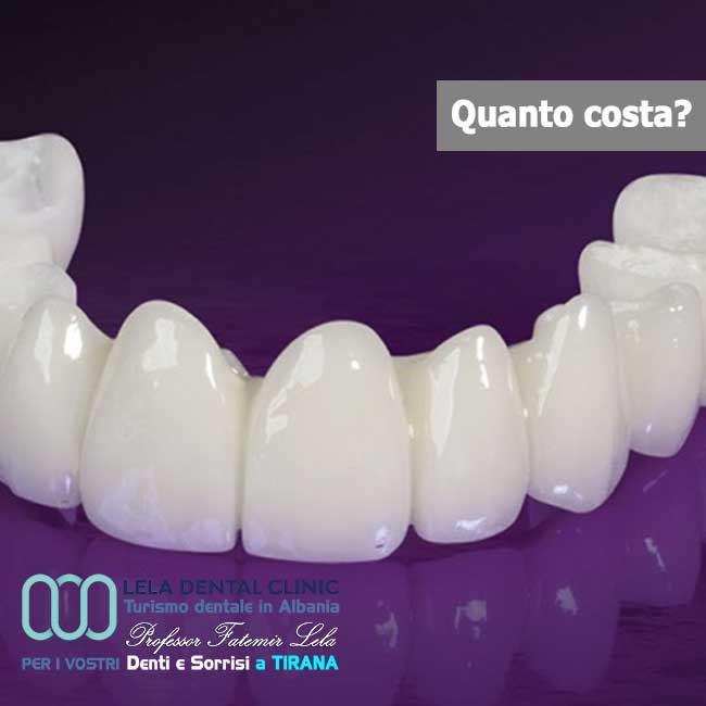 arcate-in-zirconio-senza-gengive