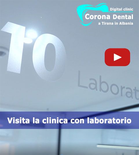 clinica-dentale-con-laboratorio-odontotecnico-corona-dental
