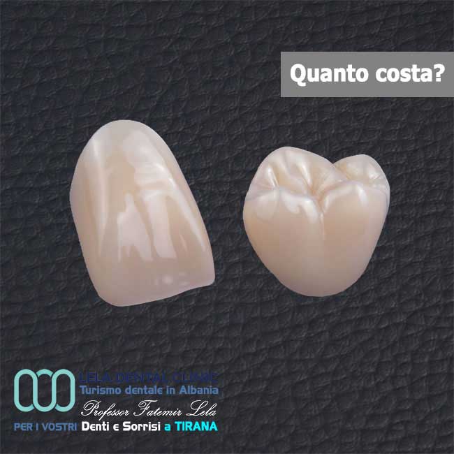 corone-in-zirconio-albania-tirana