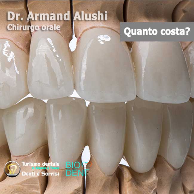 denti-corone-in-zirconio-per-estetica-dentale