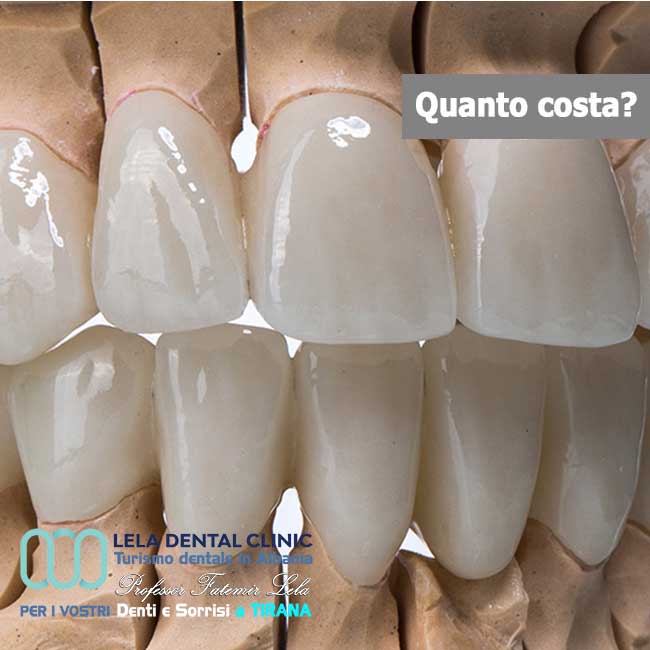 Dentista-in-Albania-con-clinica-dentale-a-Tirana-per-turismo-dentale-denti-corone-in-zirconio-per-estetica-dentale