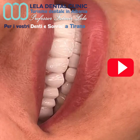 img/estetica-dentale-donna