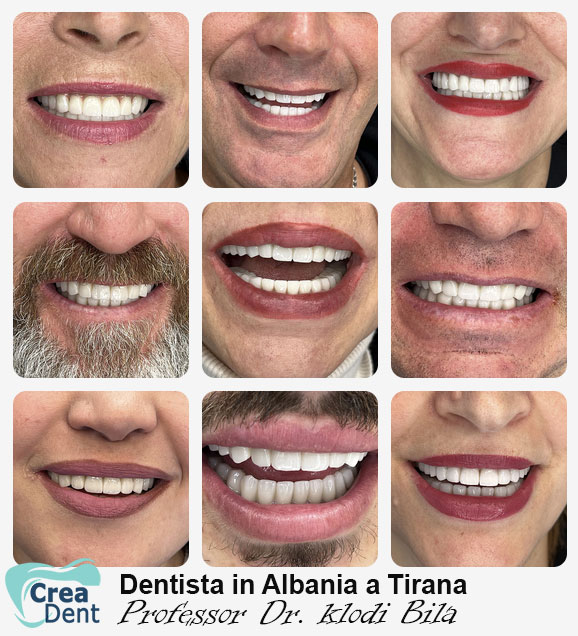 il-migliore-dentista-in-Albania-a-Tirana