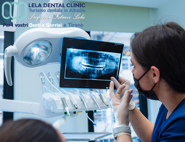 la-migliore-clinica-dentale-in-albania-tirana