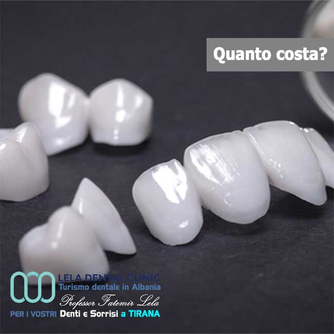 denti-singoli-ponti-e-arcate-in-zirconio
