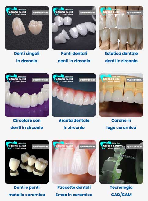 protesi-dentali