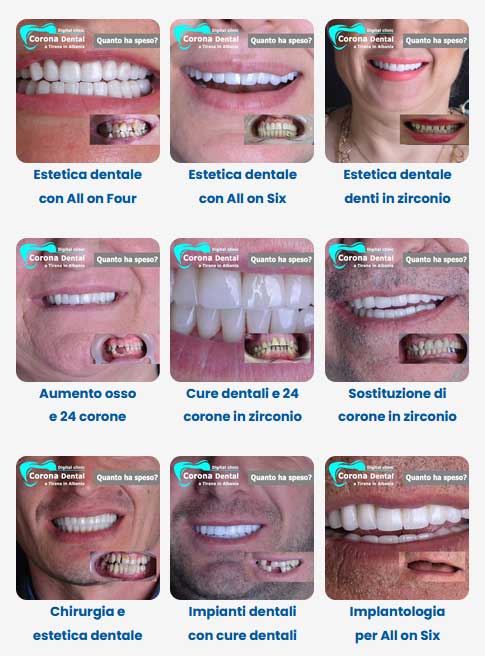risultati-delle-cure-dentali.jpg