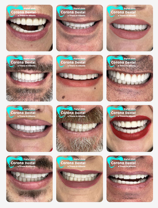 cure-dentali.jpg