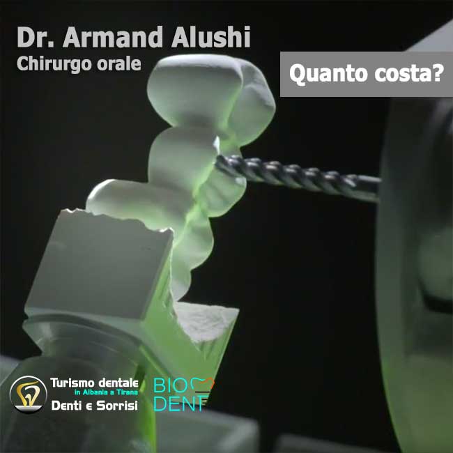 tecnologia-digitale-cad-cam-per-le-protesi-dentarie-in-albania-a-tirana