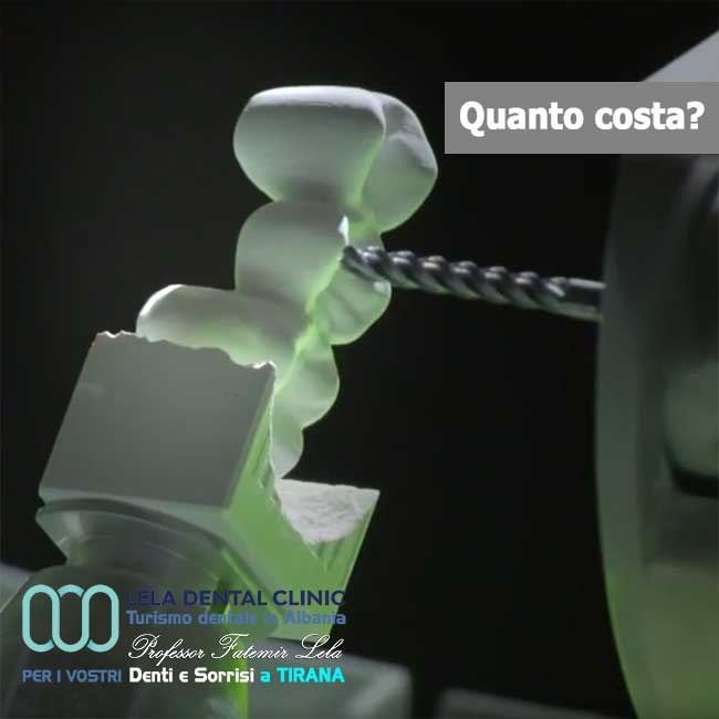 tecnologia-digitale-cad-cam-per-le-protesi-dentarie