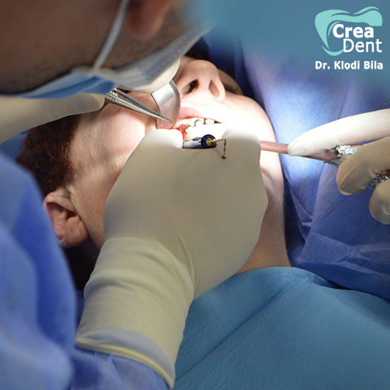 23-clinica-crea-dent-del-professor-dr-klodi-bila