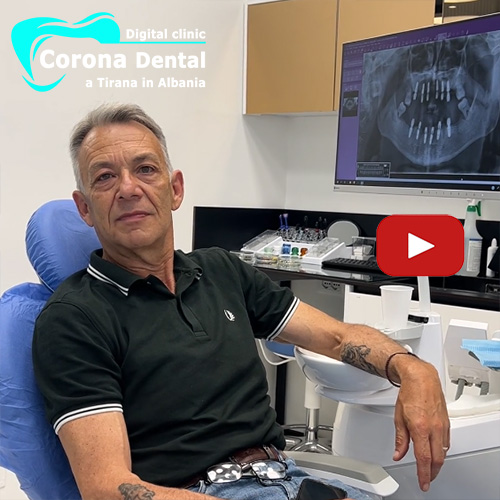 recensione-di-carmelo-corona-dental