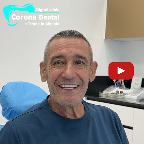 recensione-di-filippo-corona-dental