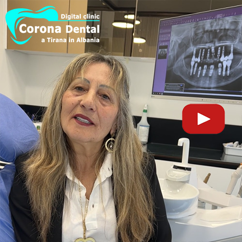 recensione-di-maddalena-corona-dental