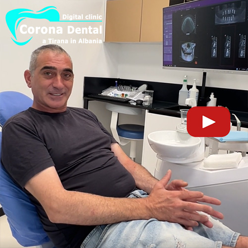 recensione-di-daniele-corona-dental