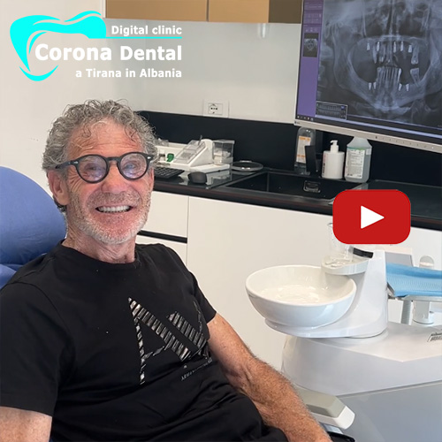 recensione-di-nazzareno-corona-dental