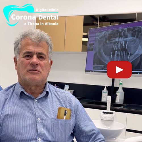 recensione-di-giovanni-corona-dental