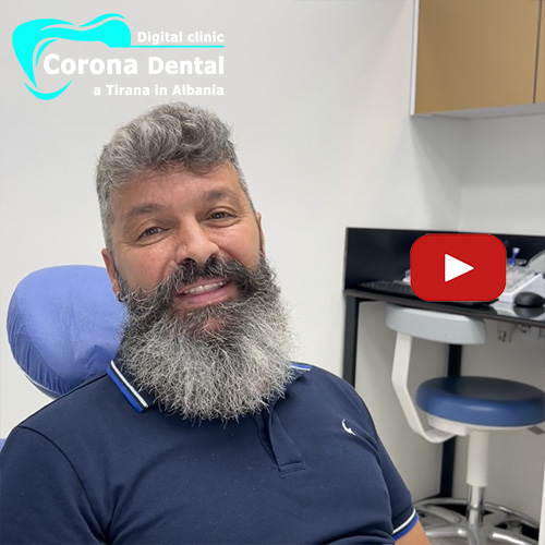 recensione-di-ivano-corona-dental