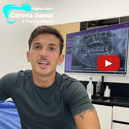 recensione-di-besi-corona-dental