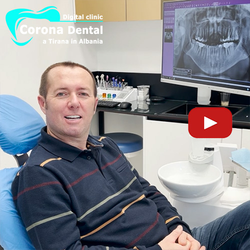 recensione-di-roberto-corona-dental