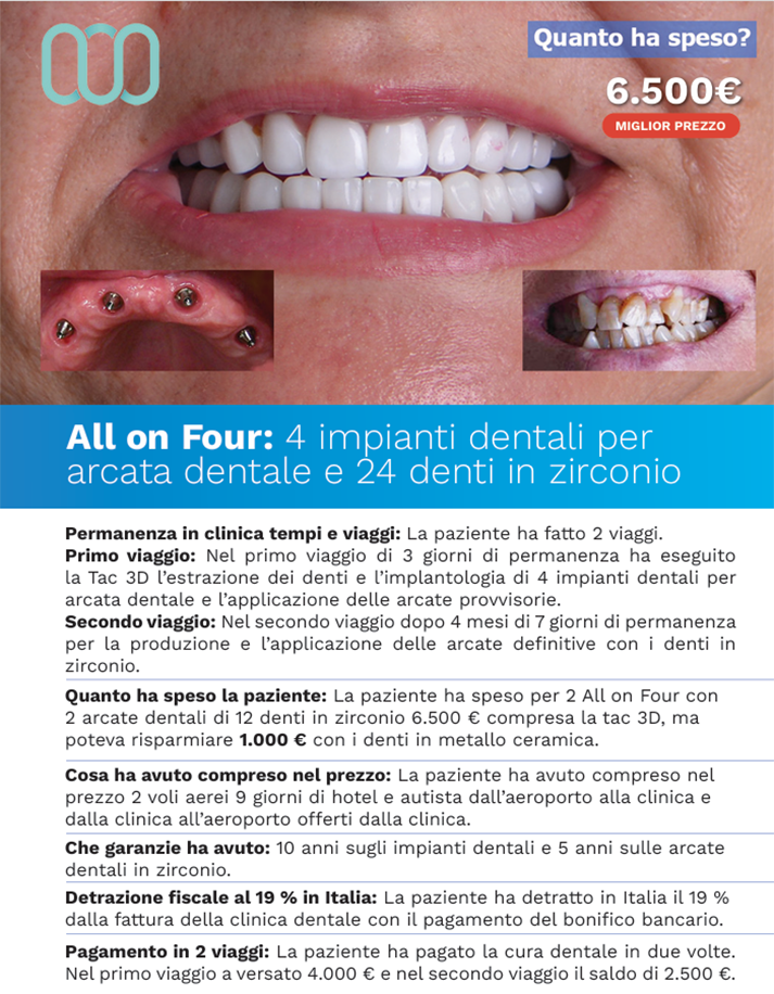 recensioni-all-on-four