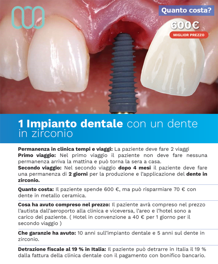 recensioni-di-un-impianto-dentale