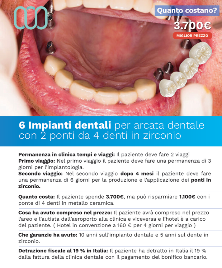 recensioni-di-sei-impianti-dentali