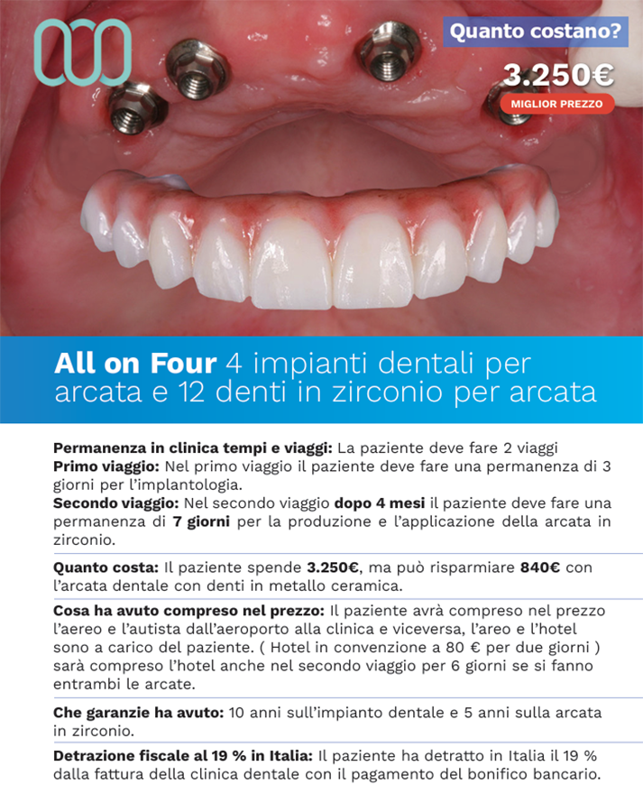 recensioni-di-quattro-impianti-dentali-per-arcata