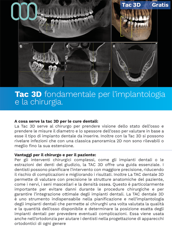 recensioni-tac-3d