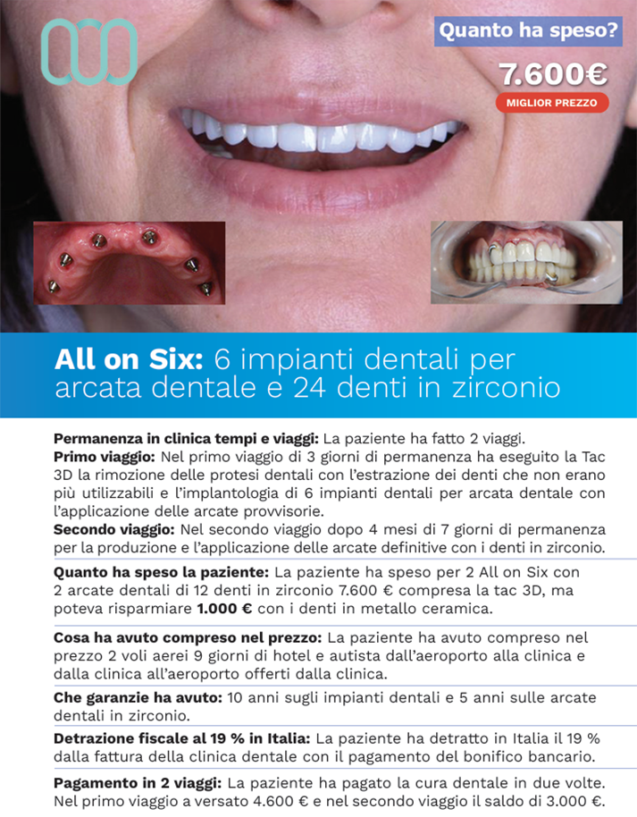 recensioni-all-on-six