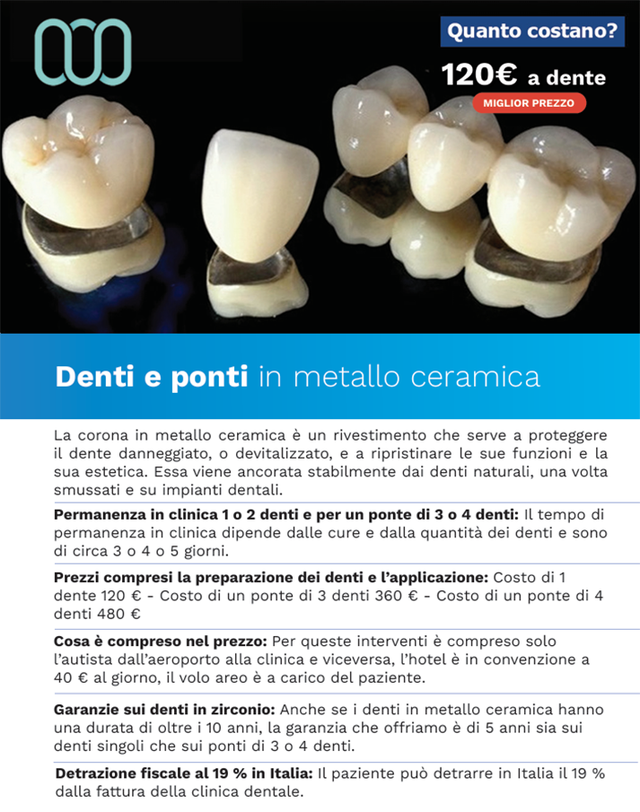 recensione-denti-in-metallo-ceramica