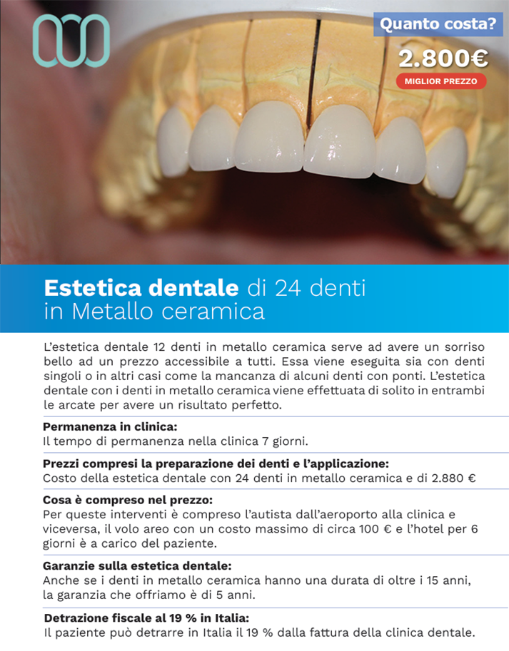 recensione-corone-in-metallo-ceramica