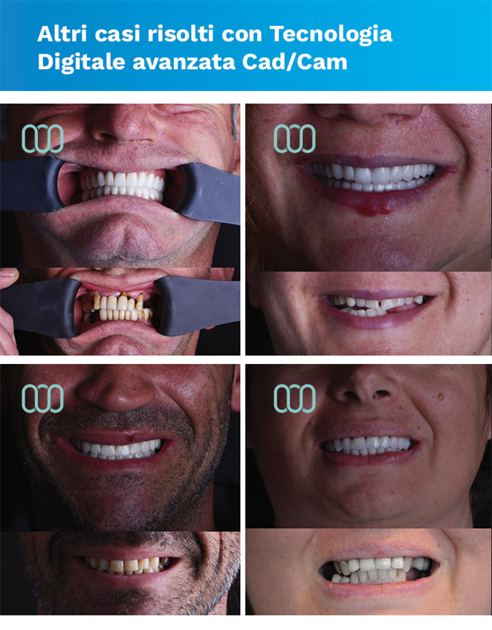 recensione-cure-dentali-lela-dental-1
