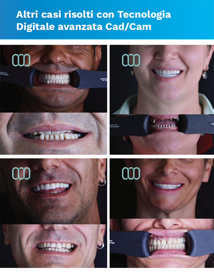 recensione-cure-dentali-lela-dental-2