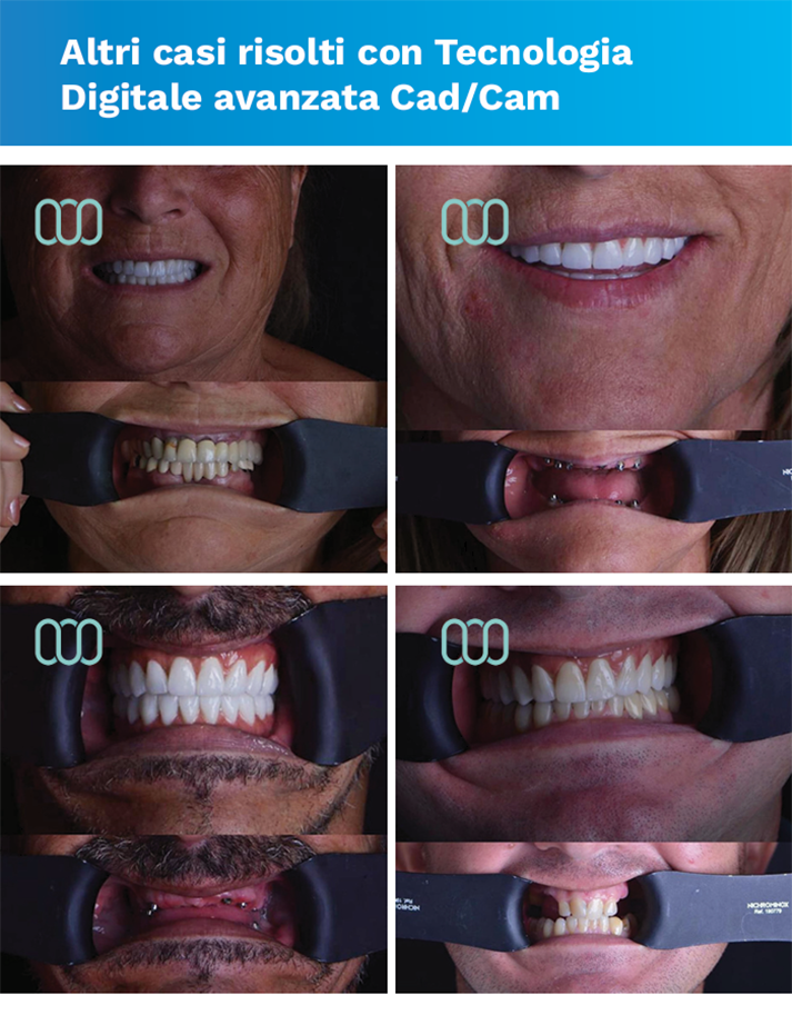 recensione-cure-dentali-lela-dental-3