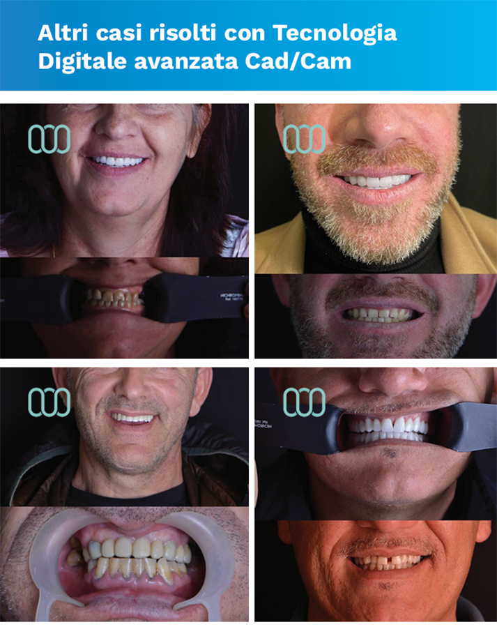 recensione-cure-dentali-lela-dental-4