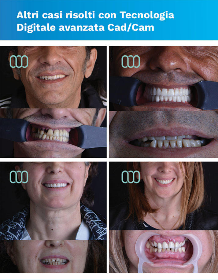 recensione-cure-dentali-lela-dental-5