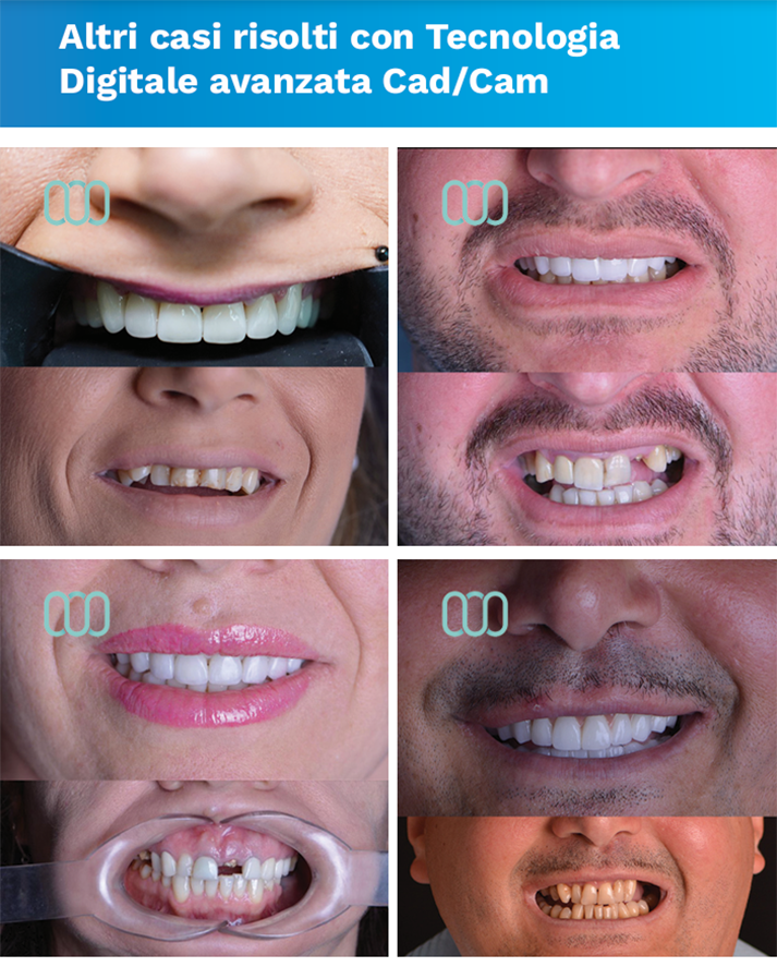 recensione-cure-dentali-lela-dental-6