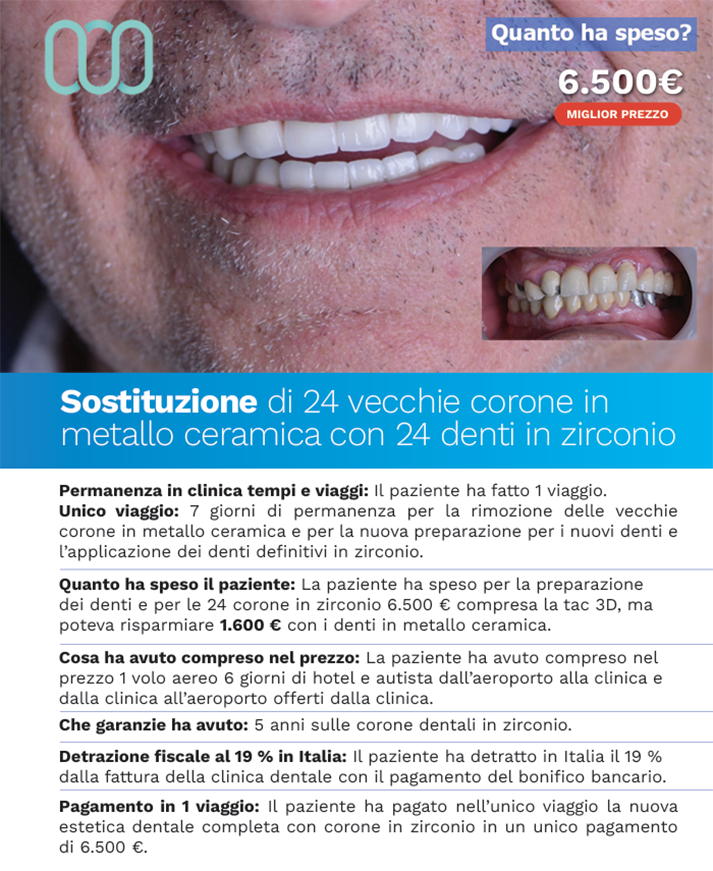 recensioni-sostituzioni-corone