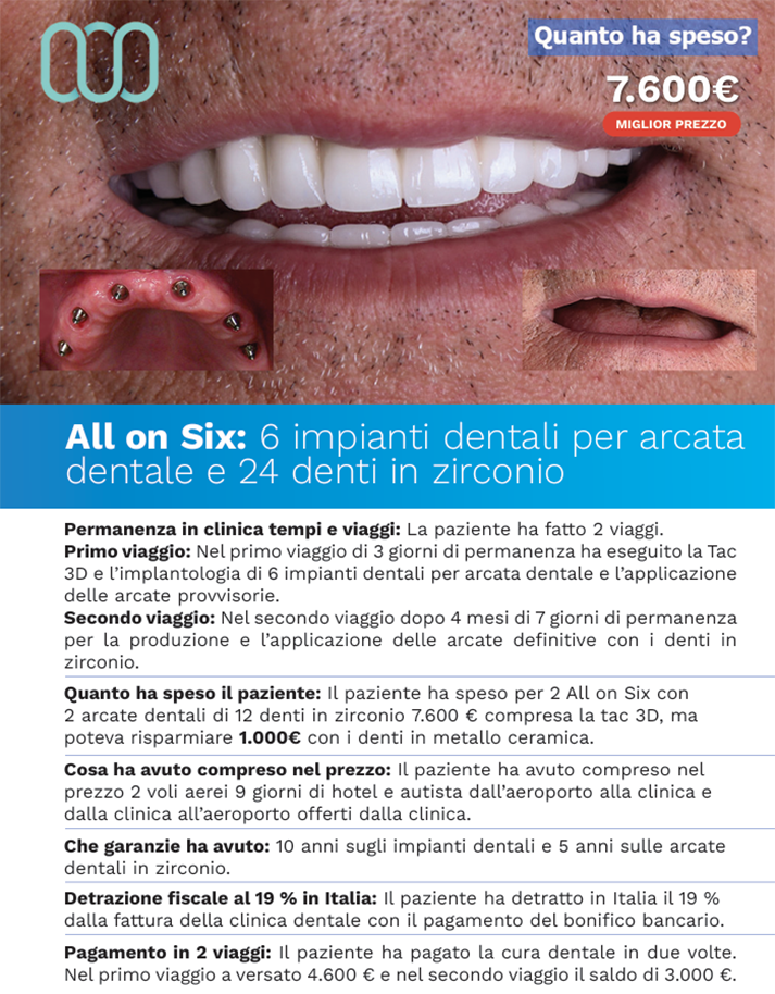 recensioni-all-on-six-lele-dental